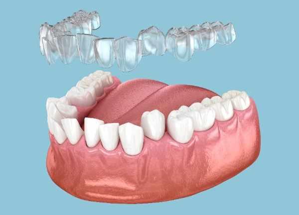emergency dentist in Basildon